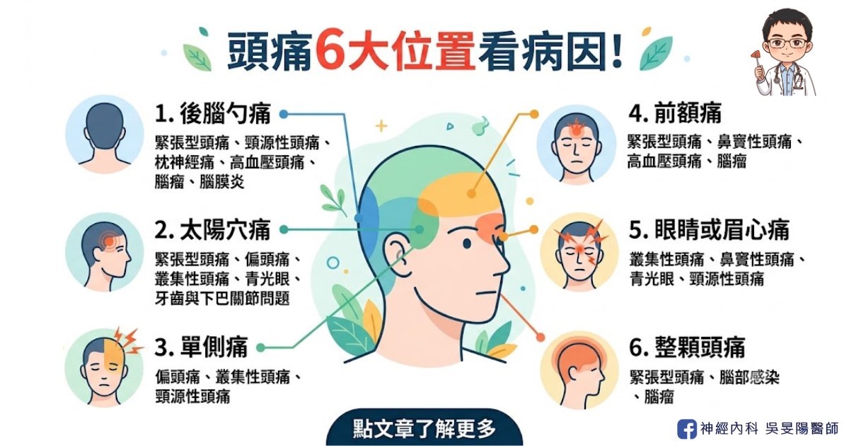 頭痛 6 大位置看病因